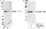 SART3/TIP110 Antibody in Western Blot (WB)