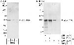 ZC3H11A Antibody in Western Blot (WB)