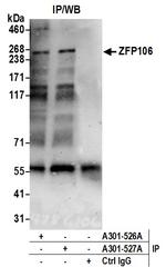 ZFP106 Antibody in Immunoprecipitation (IP)