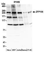 ZFP106 Antibody in Western Blot (WB)