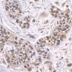 ZFP106 Antibody in Immunohistochemistry (Paraffin) (IHC (P))