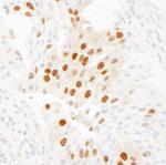 WDR77/MEP50 Antibody in Immunohistochemistry (Paraffin) (IHC (P))