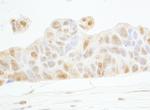 Cyclin E1 Antibody in Immunohistochemistry (Paraffin) (IHC (P))