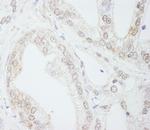 METTL3/MT-A70 Antibody in Immunohistochemistry (Paraffin) (IHC (P))