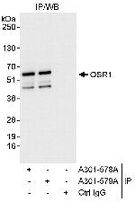 OSR1 Antibody in Immunoprecipitation (IP)