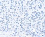 CPSF160 Antibody in Immunohistochemistry (Paraffin) (IHC (P))