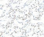 CPSF160 Antibody in Immunohistochemistry (Paraffin) (IHC (P))