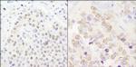 CPSF100 Antibody in Immunohistochemistry (Paraffin) (IHC (P))