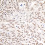 PBRM1 Antibody in Immunohistochemistry (Paraffin) (IHC (P))