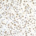 PBRM1 Antibody in Immunohistochemistry (Paraffin) (IHC (P))