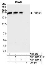 PBRM1 Antibody in Immunoprecipitation (IP)