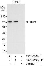 TDP1 Antibody in Immunoprecipitation (IP)