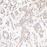 TReP-132/TRERF1 Antibody in Immunohistochemistry (Paraffin) (IHC (P))