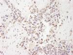 MBD2 Antibody in Immunohistochemistry (Paraffin) (IHC (P))