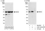 MBD2 Antibody in Western Blot (WB)