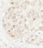 MBD4 Antibody in Immunohistochemistry (Paraffin) (IHC (P))