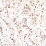 Pol Lambda Antibody in Immunohistochemistry (Paraffin) (IHC (P))