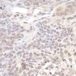 Pol Lambda Antibody in Immunohistochemistry (Paraffin) (IHC (P))