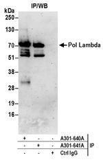 Pol Lambda Antibody in Immunoprecipitation (IP)