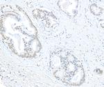 EHMT1 Antibody in Immunohistochemistry (Paraffin) (IHC (P))