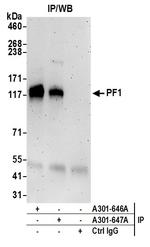 PF1 Antibody in Immunoprecipitation (IP)