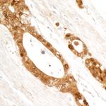 14-3-3 Sigma Antibody in Immunohistochemistry (Paraffin) (IHC (P))