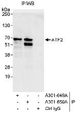 ATF2 Antibody in Immunoprecipitation (IP)