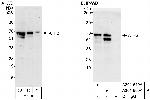 ATF2 Antibody in Western Blot (WB)