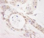 PUS1 Antibody in Immunohistochemistry (Paraffin) (IHC (P))