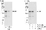 cAbl Antibody in Western Blot (WB)