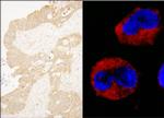 cAbl Antibody in Immunohistochemistry (Paraffin) (IHC (P))