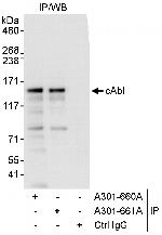 cAbl Antibody in Immunoprecipitation (IP)