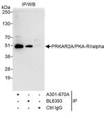 PRKAR2A/PKA-RIIalpha Antibody in Immunoprecipitation (IP)