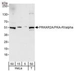 PRKAR2A/PKA-RIIalpha Antibody in Western Blot (WB)