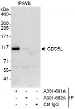 CDC5L Antibody in Immunoprecipitation (IP)