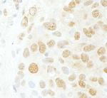 CDC5L Antibody in Immunohistochemistry (Paraffin) (IHC (P))