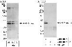 eEF2 Kinase Antibody in Western Blot (WB)