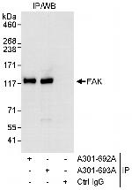 FAK Antibody in Immunoprecipitation (IP)