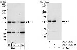 FAK Antibody in Western Blot (WB)