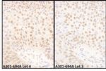 BMI1 Antibody in Immunohistochemistry (Paraffin) (IHC (P))