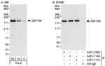 ZNF198 Antibody in Western Blot (WB)