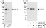 ZNF198 Antibody in Western Blot (WB)