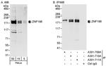 ZNF198 Antibody in Western Blot (WB)