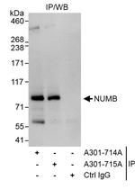 NUMB Antibody in Immunoprecipitation (IP)