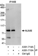 NUMB Antibody in Immunoprecipitation (IP)