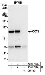 OCT1 Antibody in Immunoprecipitation (IP)