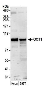 OCT1 Antibody in Western Blot (WB)