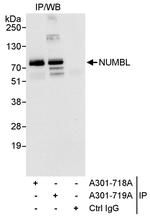 NUMBL Antibody in Immunoprecipitation (IP)