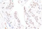 FBW7 Antibody in Immunohistochemistry (Paraffin) (IHC (P))