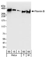 Filamin B Antibody in Western Blot (WB)